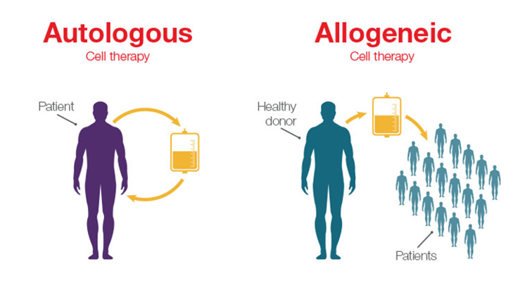 ارتقا درمان آلوژنیک بر پایه‌ی سلول‌های ایمنی با همکاری سه گروه مختلف